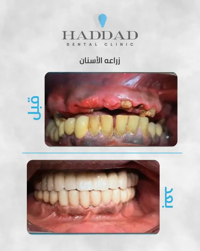 Bassem Haddad Clinic - Social media design 1 | MAZCODEX portfolio