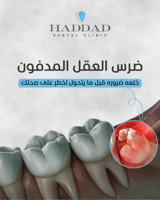 Bassem Haddad Clinic - Social media design 4 | MAZCODEX portfolio