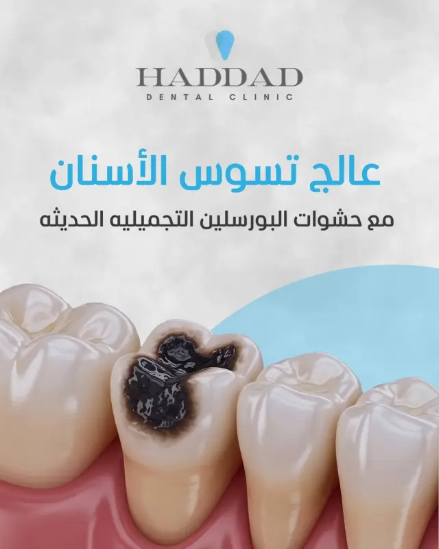 Bassem Haddad Clinic - Social media design 12 | MAZCODEX portfolio